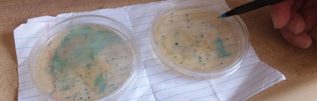 Testing for e-coli